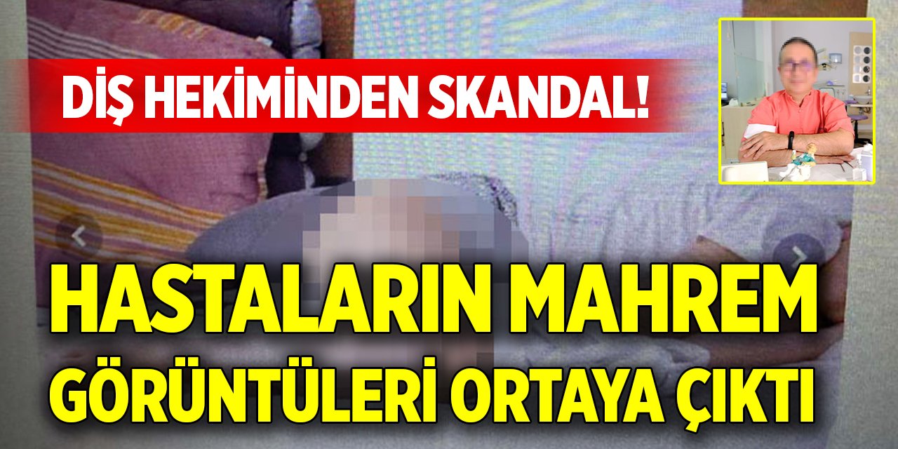 Diş hekiminden skandal! Hastaların mahrem görüntüleri ortaya çıktı
