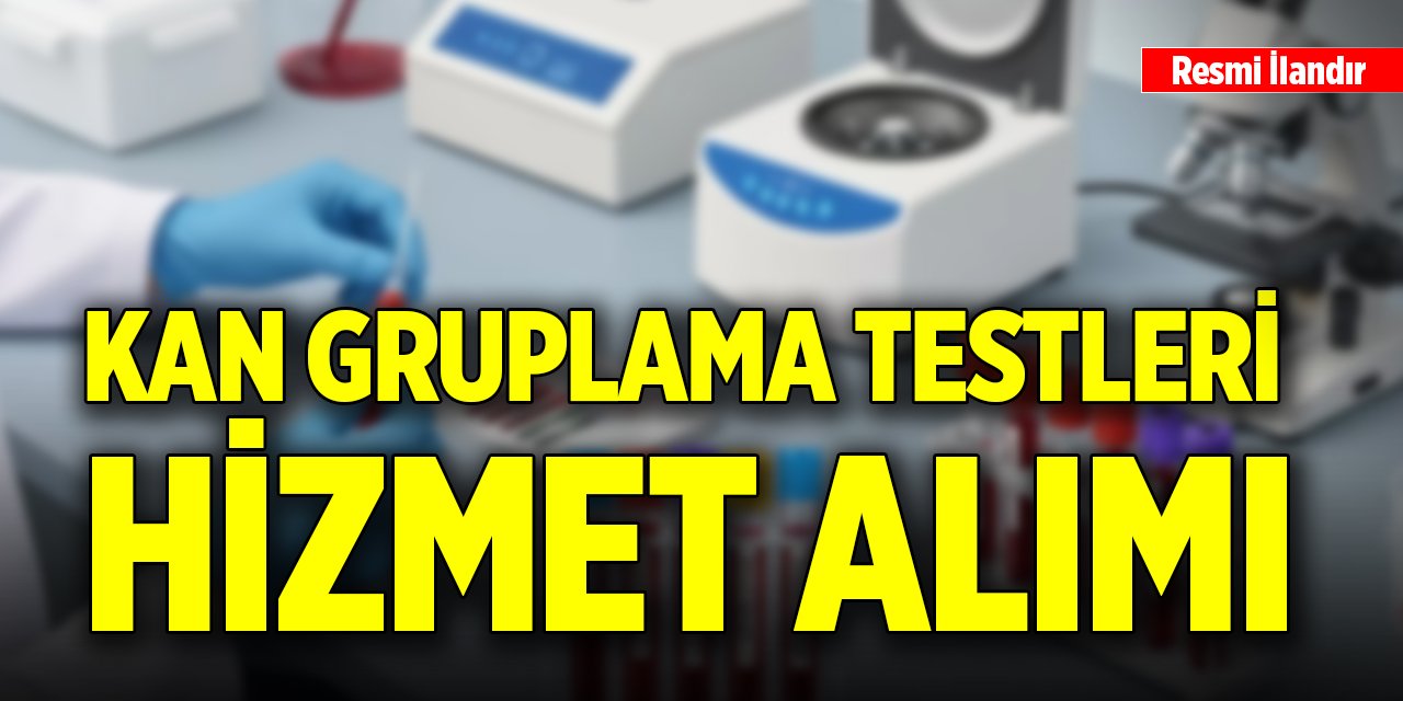 Kan gruplama testleri hizmet alımı