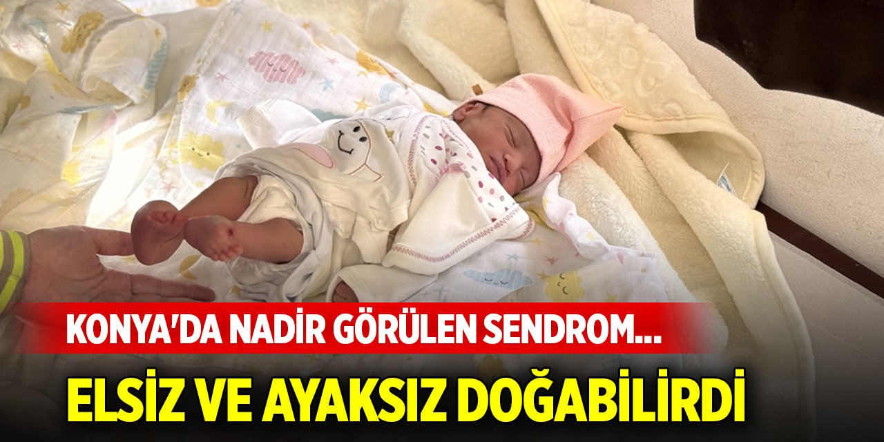 Konya'da nadir görülen sendrom... Elsiz ve ayaksız doğabilirdi