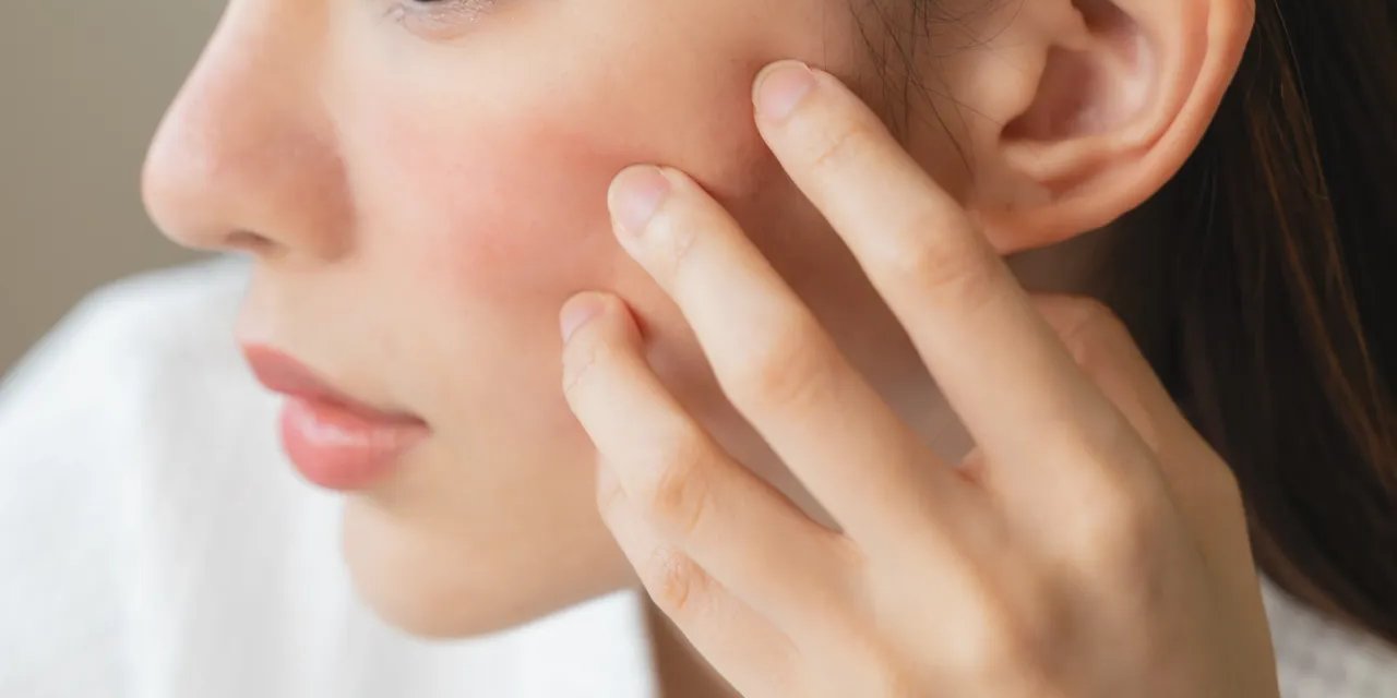 Cilt kuruluğunun gizli sebebi