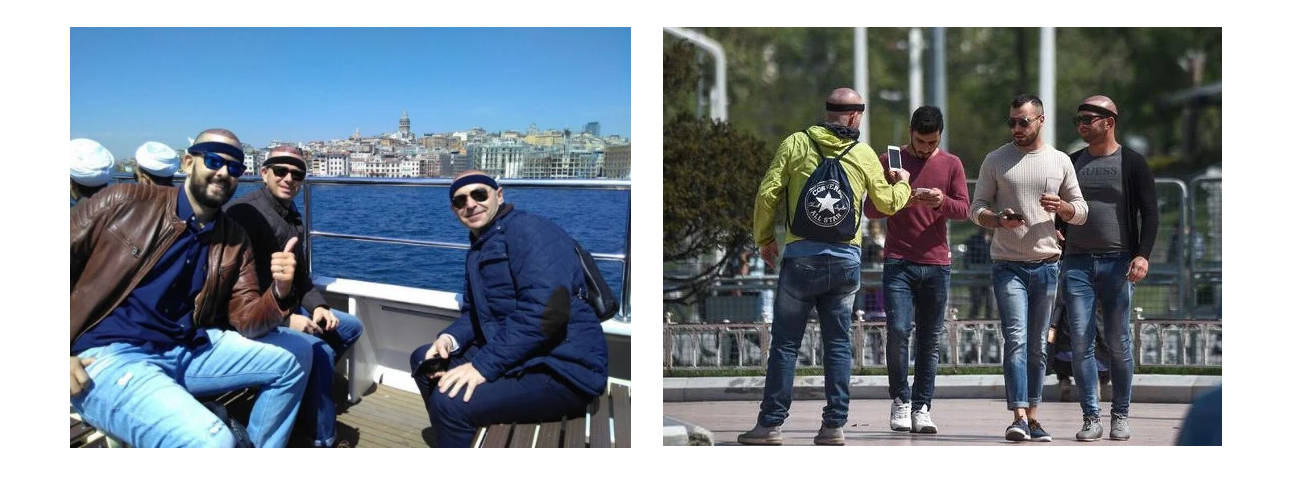 Hair Transplant Turkey Cost