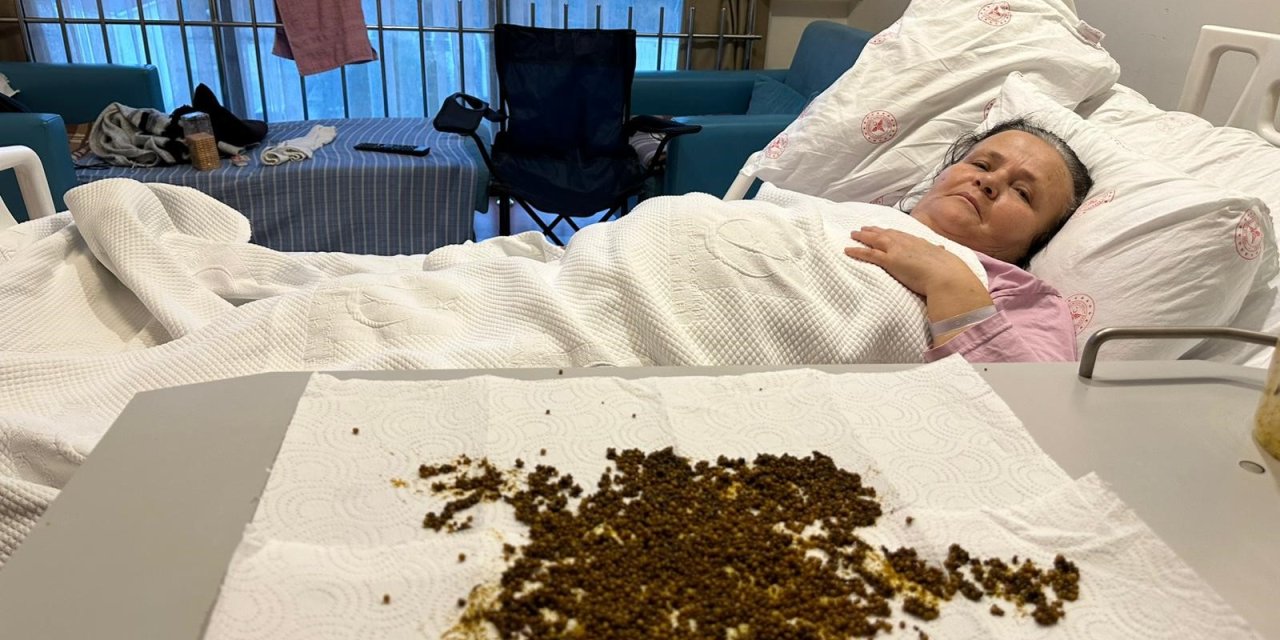 Bu bir rekor! Hastadan çıkan taşları sayamadılar