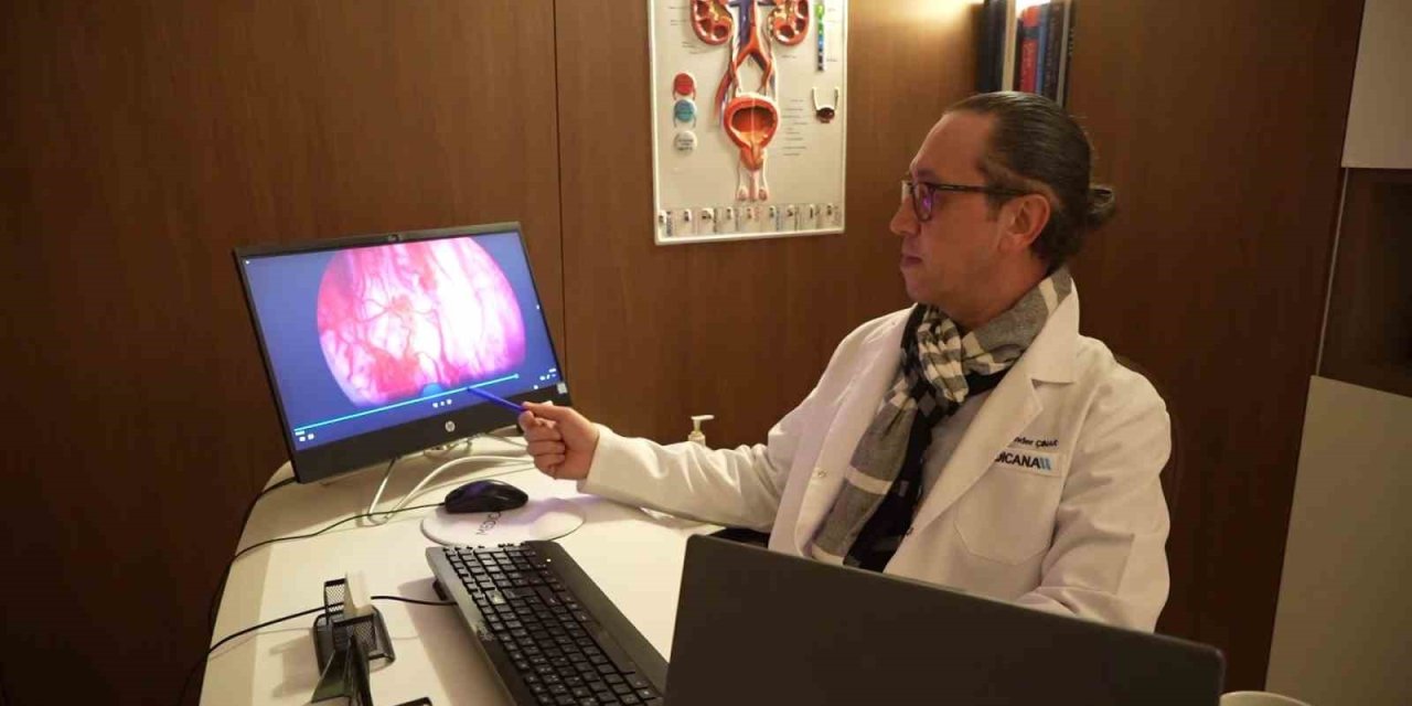 50 yaş üstü erkeklerde prostat tedavisinde en etkili yöntem: Holep