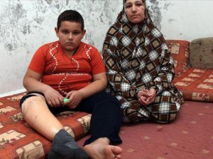 Syrian refugees speak of physical, emotional injuries