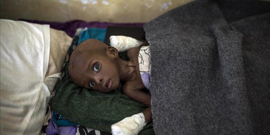 400,000 Congolese children risk starvation, UNICEF says