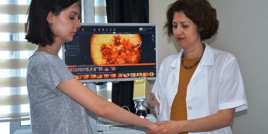 ADÜ Hastanesinde ücretsiz deri kanseri taraması yapıldı