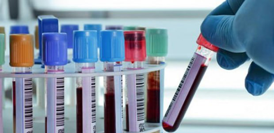 Tek kan testiyle 20 kanser türü tespit edilebiliyor