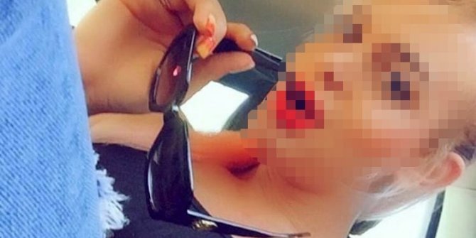Bıçaklanarak öldürülen travesti davasının tek görgü tanığı: “Naz’ın yalvarışını hatırlıyorum. ‘Öldür beni’ diye yalvarıyordu”