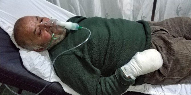 Yangında hayvanları kurtarmak isterken hastanelik oldu