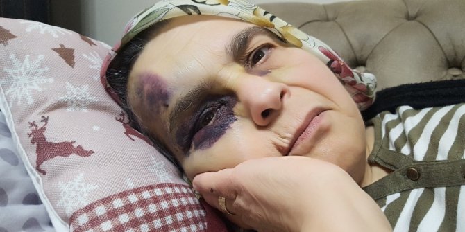 Şehir zorbası yaşlı çifti öldüresiyle dövdü