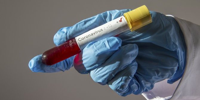 Henüz koronavirüs vakası bildirilmeyen Tacikistan’da karantinada tutulan bir kişi öldü