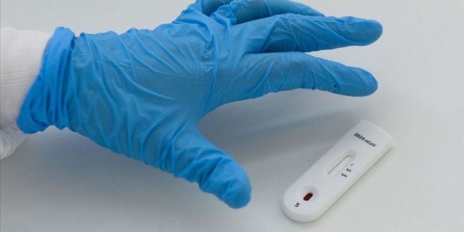 Dünya genelinde Kovid-19 vaka sayısı 2 milyon 200 bini aştı