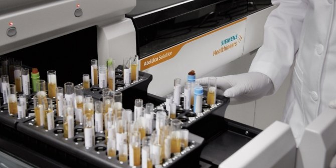 Koronavirüse karşı bağışıklık ölçen test