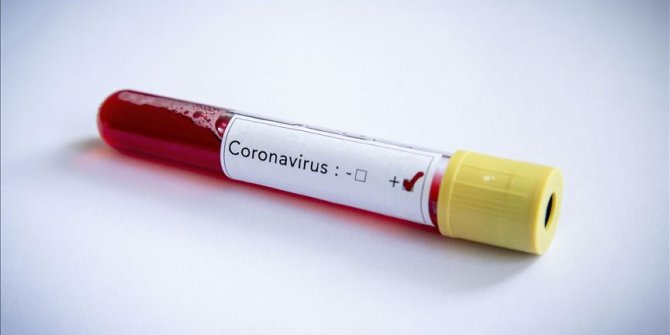 BiH: U dobojskoj bolnici preminula žena pozitivna na koronavirus