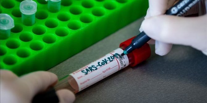 Srbija: U ustanovama socijalne zaštite koronavirus potvrđen kod 155 osoba