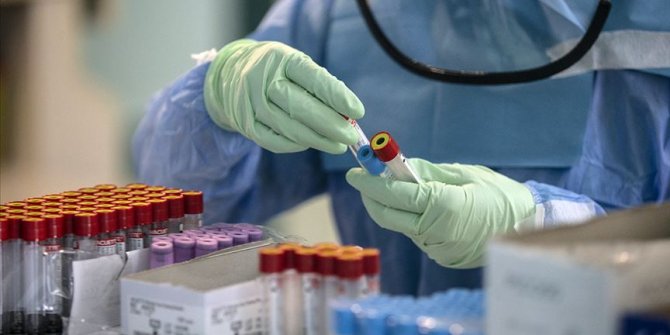 Kovid-19, tiroit dokusuna karşı antikor fazlalığı oluşturuyor