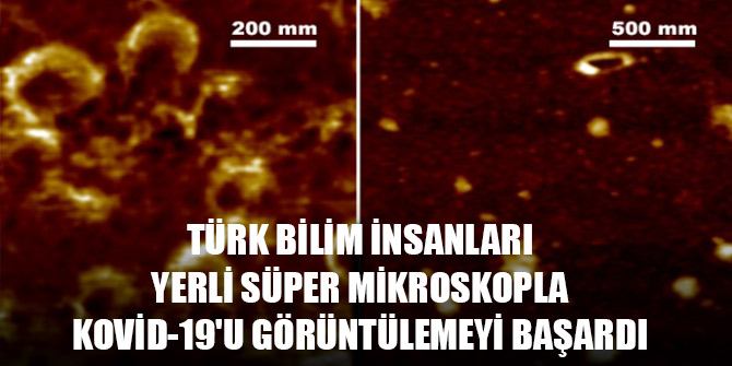 Türk bilim insanları yerli süper mikroskopla Kovid-19'u görüntülemeyi başardı