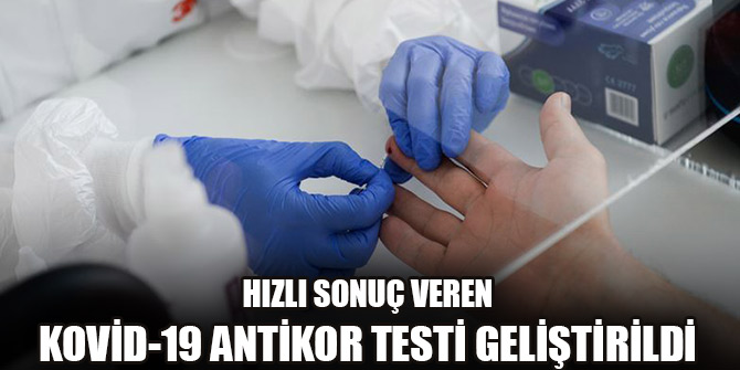 İngiltere'de hızlı sonuç veren Kovid-19 antikor testi geliştirildi