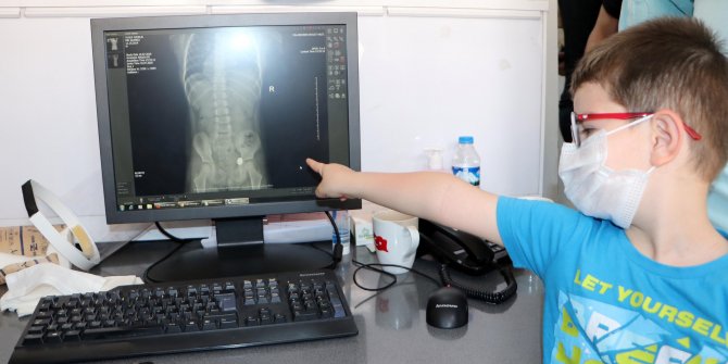 5 yaşındaki Yusuf, karnındaki paraya böyle baktı