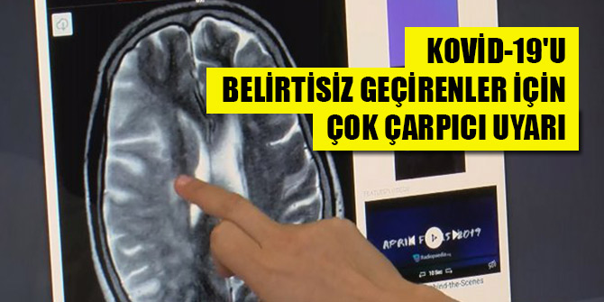 Kovid-19'u belirtisiz geçirenler için çok çarpıcı uyarı