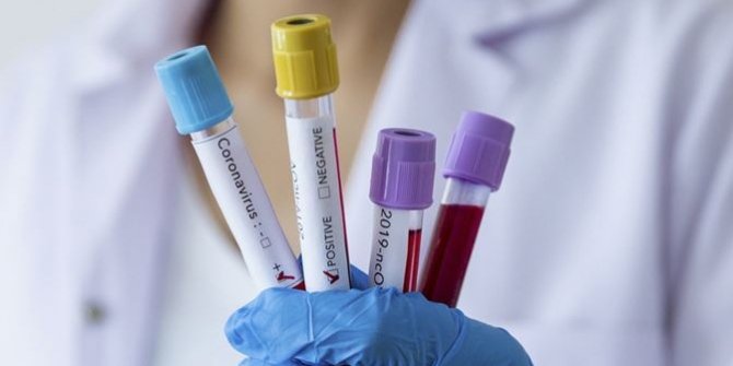 Cumhuriyetçi kongre üyesinin Beyaz Saray'da yaptırdığı Kovid-19 testi pozitif çıktı