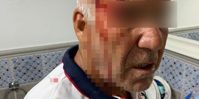 ’Siz kiracısınız, bu yolu kullanmayın’ kavgası kanlı bitti
