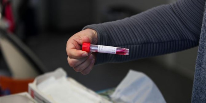 BiH: U Kantonu Sarajevo 283 osobe novozaražene koronavirusom