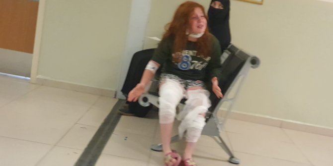 Üzerine çaydanlık devrilen Eda, yaralandı