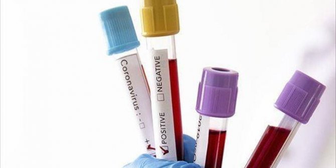 Turki laporkan 30.103 kasus baru Covid-19