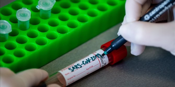 BiH: Od početka pandemije na koronavirus bilo pozitivno 89.085 osoba