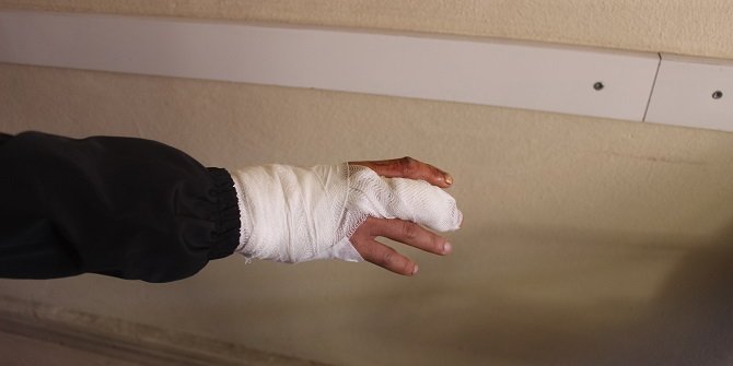 Karapınar'da sokak köpeğinin saldırdığı genç yaralandı