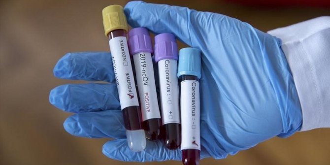 Israel counts additional 5,800 coronavirus infections