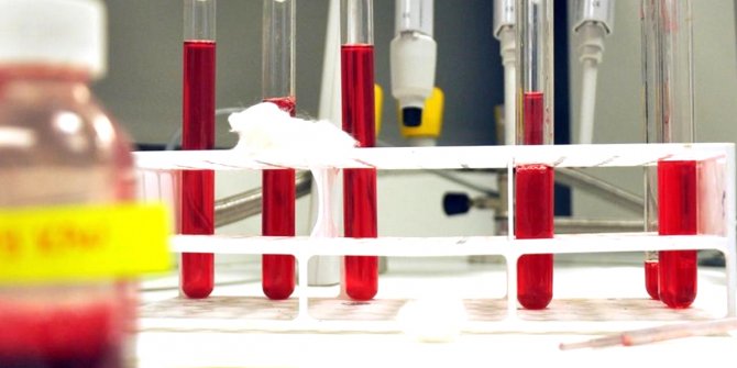 5 years ago local artificial blood was produced