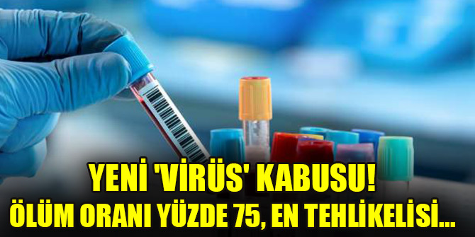 Yeni 'virüs' kabusu! Ölüm oranı yüzde 75, en tehlikelisi...
