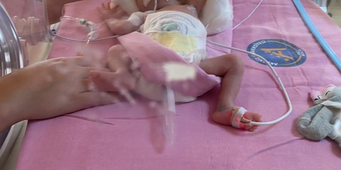 Sağlık Bakanlığı'nın sahip çıktığı Alicia bebek, 1 yaşına girdi