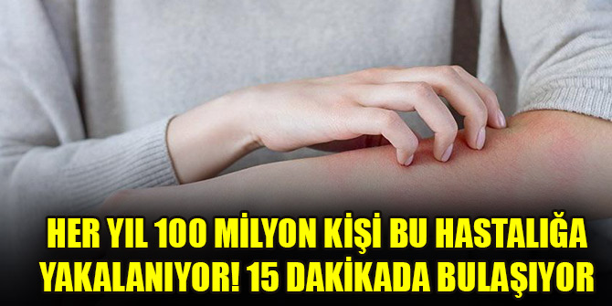 Her yıl 100 milyon kişi bu hastalığa yakalanıyor! 15 dakikada bulaşıyor, 6 haftada iyileşiyor