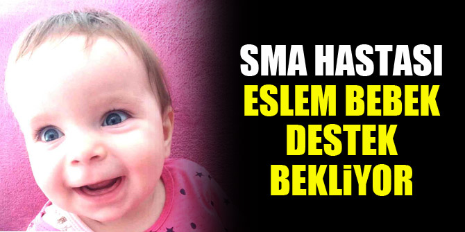 SMA hastası Eslem bebek destek bekliyor