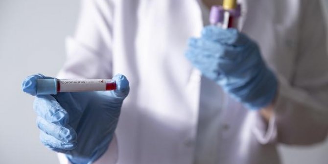 Rusya'da mutasyonları tespit eden test geliştirildi