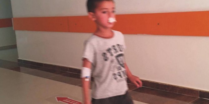 Adıyaman’da atın teptiği çocuk yaralandı