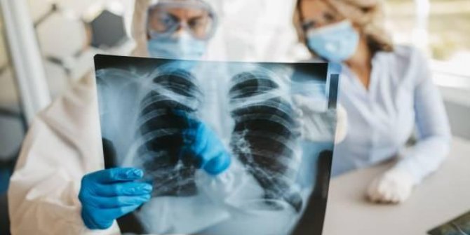 Oxford Üniversitesi'nin araştırması koronavirüs gerçeğini ortaya çıkardı