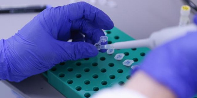 Yerli VLP aşısı Delta varyantına karşı test edilecek