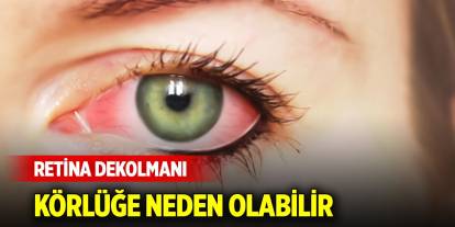 Uzman isim uyardı: Karanlık bir perde gibi... Körlüğe neden olabilir