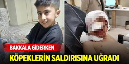 Bakkala giderken köpeklerin saldırısına uğrayan Murat, ağır yaralandı