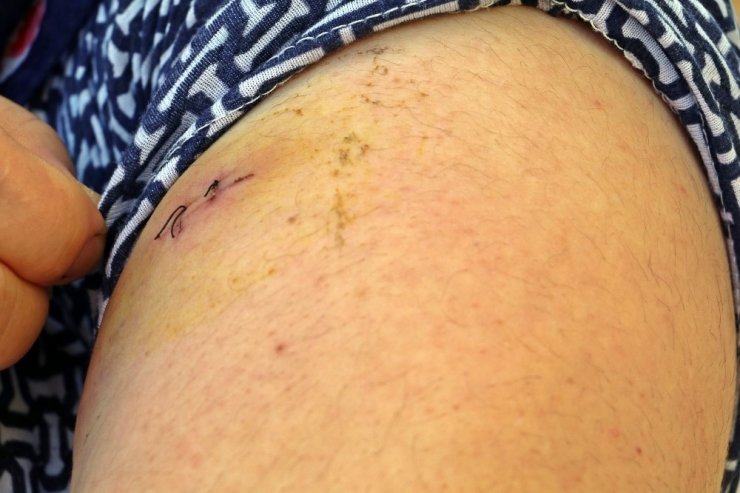 Eşini 21 yerinden bıçakladı, “Yeşil gözlerine kurban olurum” dedi