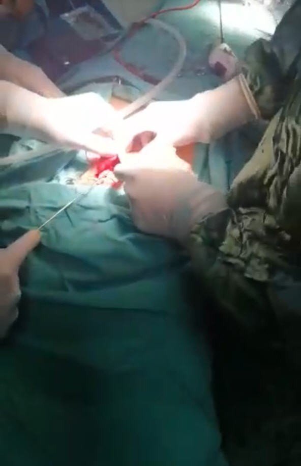 Nevşehir’de ilk kez ağız içinden guatr ameliyatı yapıldı