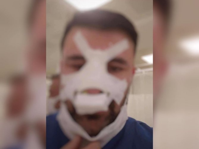 Konya'da bayram günü şok olay! Sağlık çalışanının burnunu kırdı