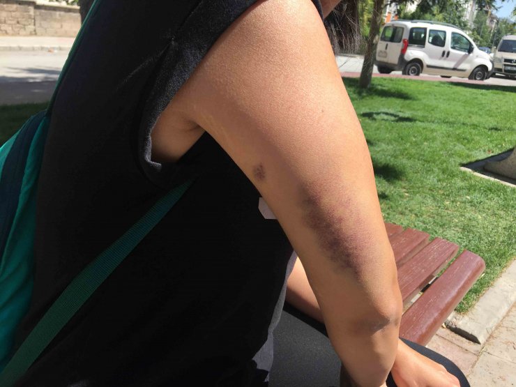 Konya'da kız kardeşler belediye otobüsünde dövüldü