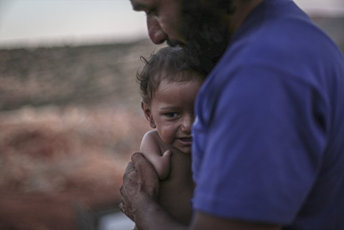 Doğuştan ayak ve kolları olmayan Muhammed bebek İdlib'de yaşam mücadelesi veriyor