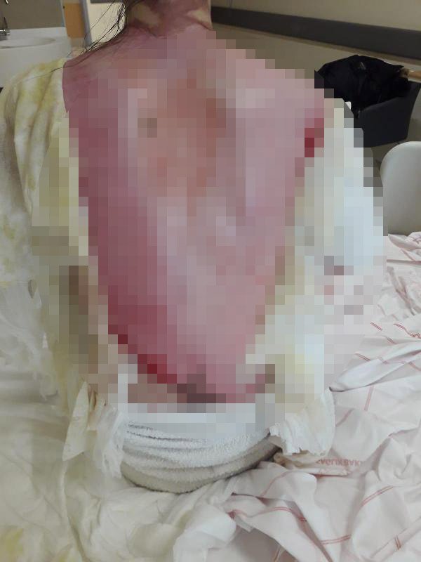 Eşinin ve 1,5 yaşındaki kızının üzerine kaynar su döken koca: Kazara oldu