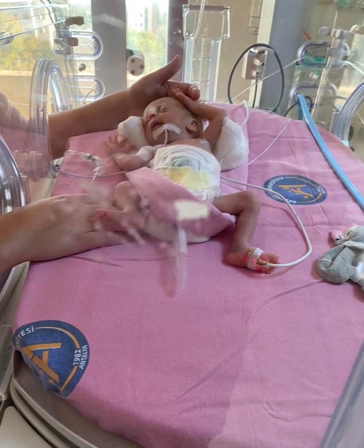 Sağlık Bakanlığı'nın sahip çıktığı Alicia bebek, 1 yaşına girdi